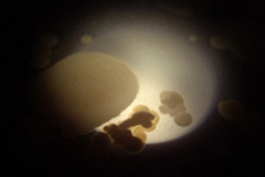 Plating environmental bacteria on Agar- under a microscope
